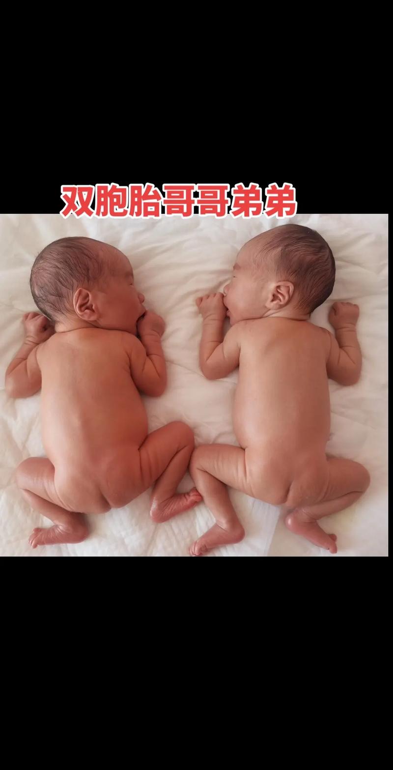 抖音双胞胎视频制作，如何用手机一键克隆分身？多机位拍摄与后期抠图技巧，新手也能快速上手的秘诀是什么？