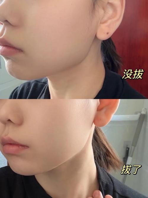 抖音脸牙变大效果是怎么实现的？是美颜滤镜的参数调整还是特定拍摄技巧？求具体操作步骤！