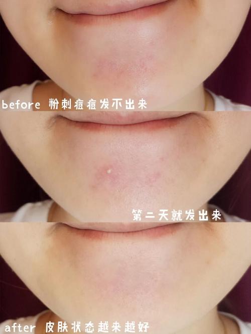 达令和小红书哪个好